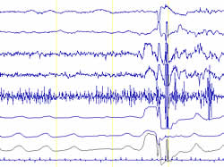 Absolute Truth - Polygraphing - Polygraphs - Lie Detectors - Crime investigation - Private Investigators